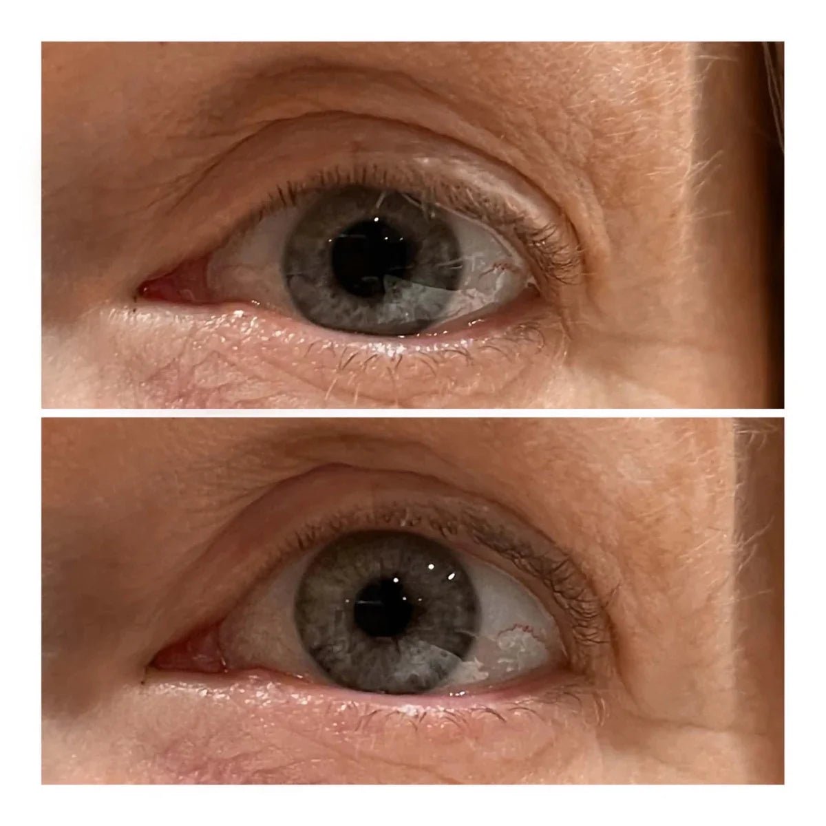 Varita Lifting de Ojos - Solvia IT