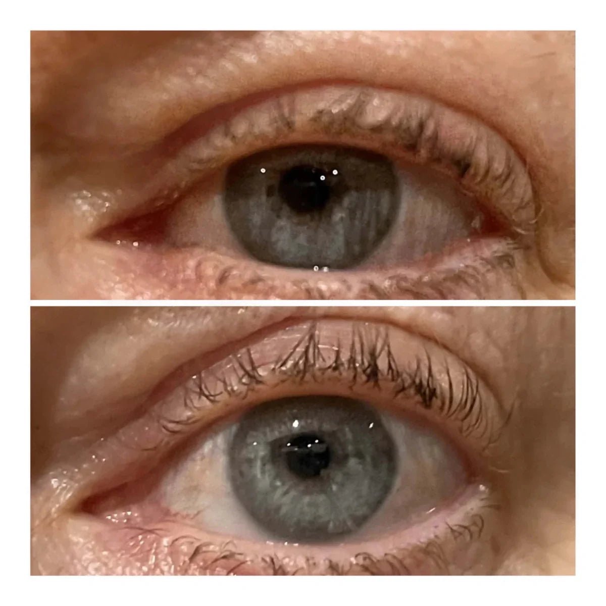 Varita Lifting de Ojos - Solvia IT