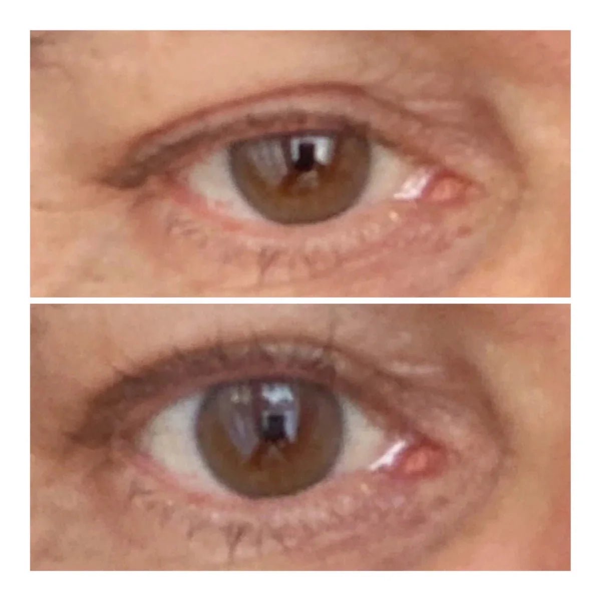 Varita Lifting de Ojos - Solvia IT