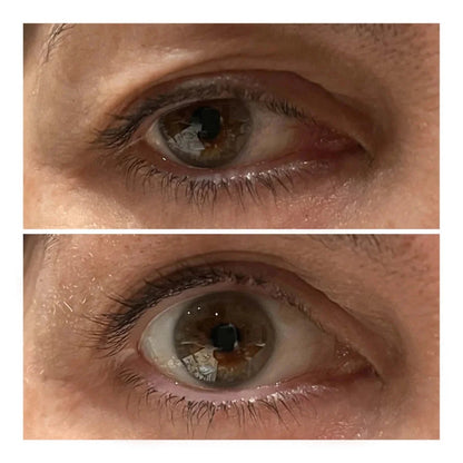 Varita Lifting de Ojos - Solvia IT