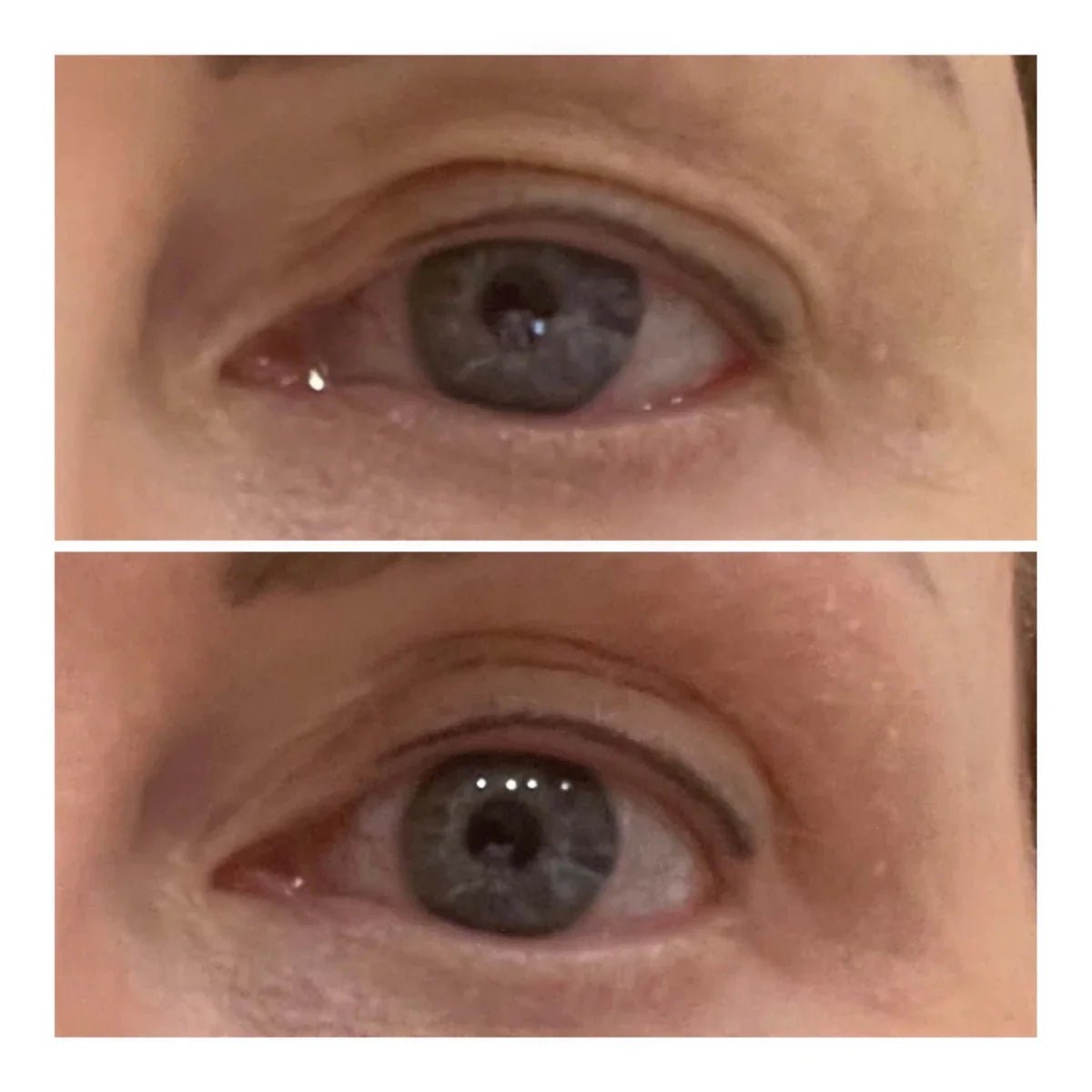 Varita Lifting de Ojos - Solvia IT
