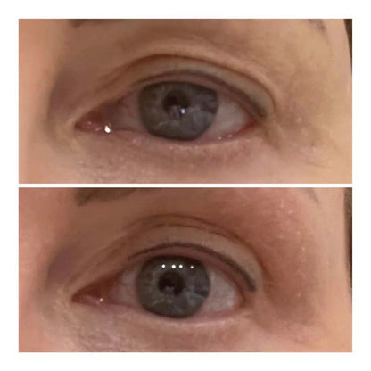 Varita Lifting de Ojos - Solvia IT